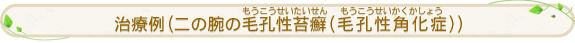 ���×�i��̘r�̖эE����ᝁi�эE���p���ǁj�i��������������������i���������������������傤�j�j�j