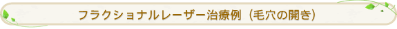 �t���N�V���i�����[�U�[���×�i�ь��̊J���j