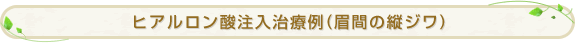 �q�A�������_�������×�i���Ԃ̏c�W���j
