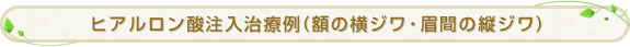 �q�A�������_�������×�i���Ԃ̉��W���E�c�W���j