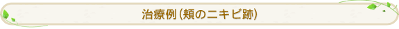 ���×�i�j�̃j�L�r�Ձj