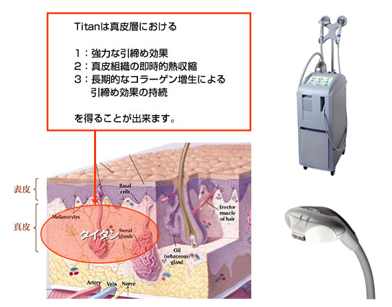 �^�C�^���@���m