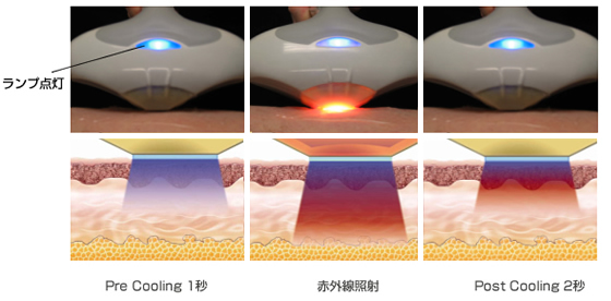 �^�C�^���@���m