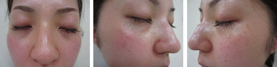 ��V���^�烁���m�T�C�g�[�V�X