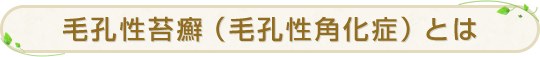 毛孔性苔癬（毛孔性角化症）とは