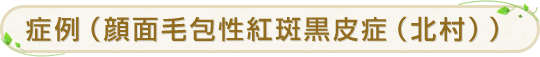 症例（顔面毛包性紅斑黒皮症（北村））