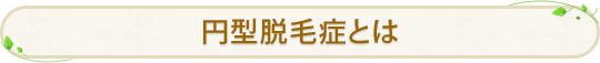 円型脱毛症とは
