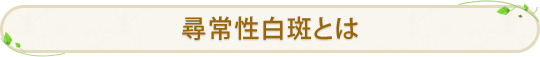 尋常性白斑とは