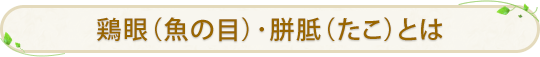 鶏眼（魚の目）･胼胝（たこ）とは